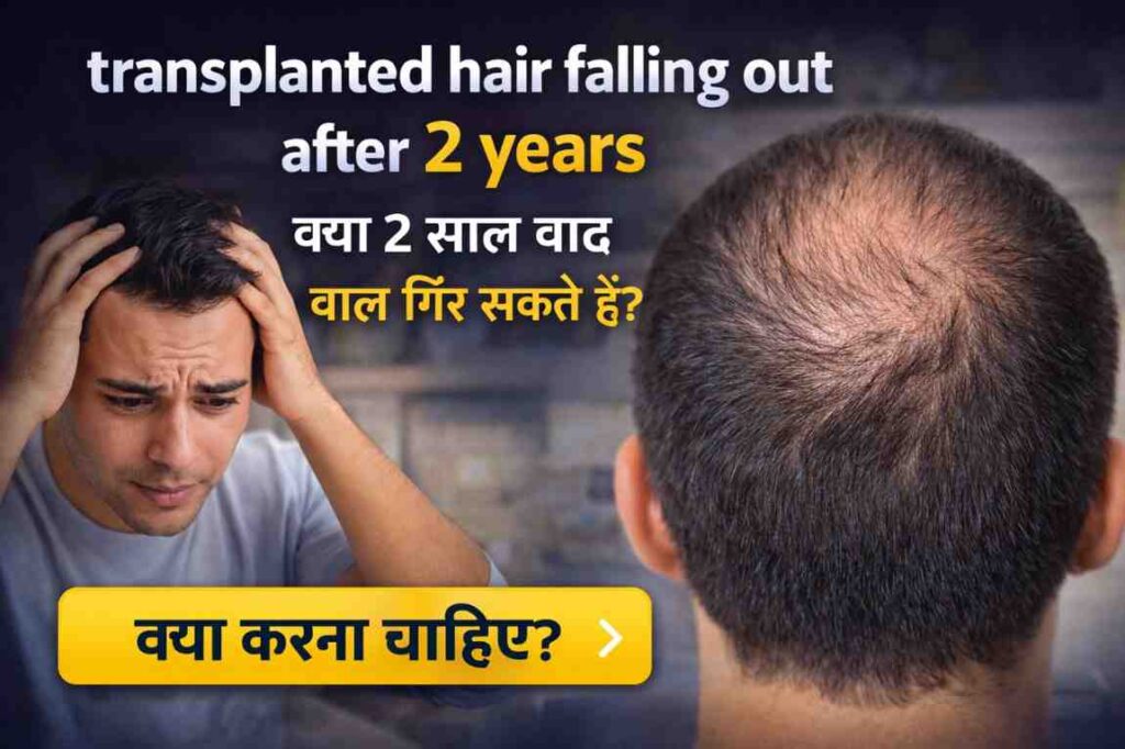 Transplanted Hair Falling Out After 2 Years